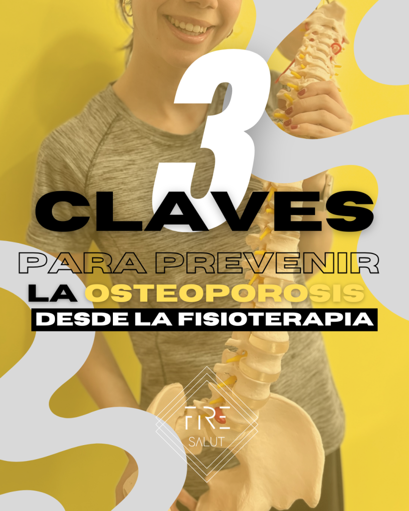 OSTEOPOROSIS: PREVENCION